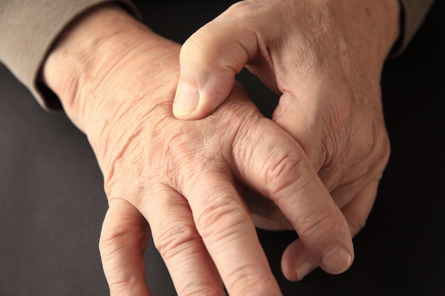 Käte suremine võib muutuda krooniliseks.
