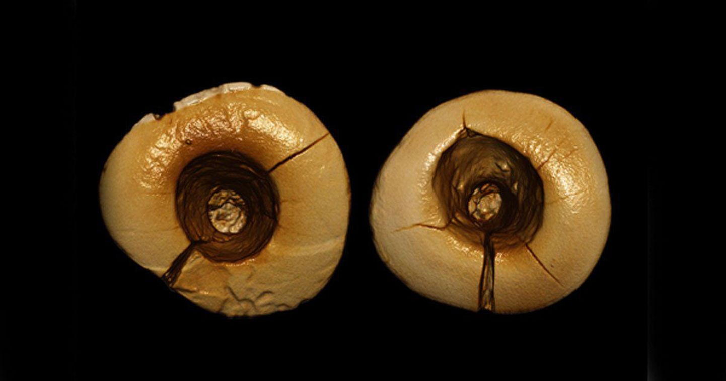 13 000 aastat tagasi pandi hammastesse juba plomme