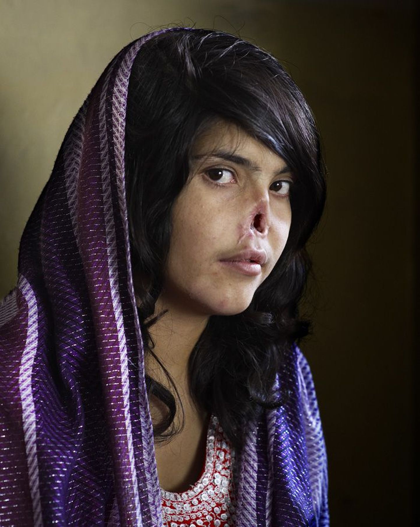 Aasta foto 2010. Afganistani naine Bibi Aisha põgenes oma vägivaldse abikaasa eest vanematekoju. Talibani võitlejad mõistsid ta üle kohut, karistuseks lõikasid Bibi mees ja mehevend ära naise nina ning kõrvad. Hüljatud naise päästsid humanitaarabitöötajad ja Ameerika sõjaväelased. Praegu elab Bibi USAs.