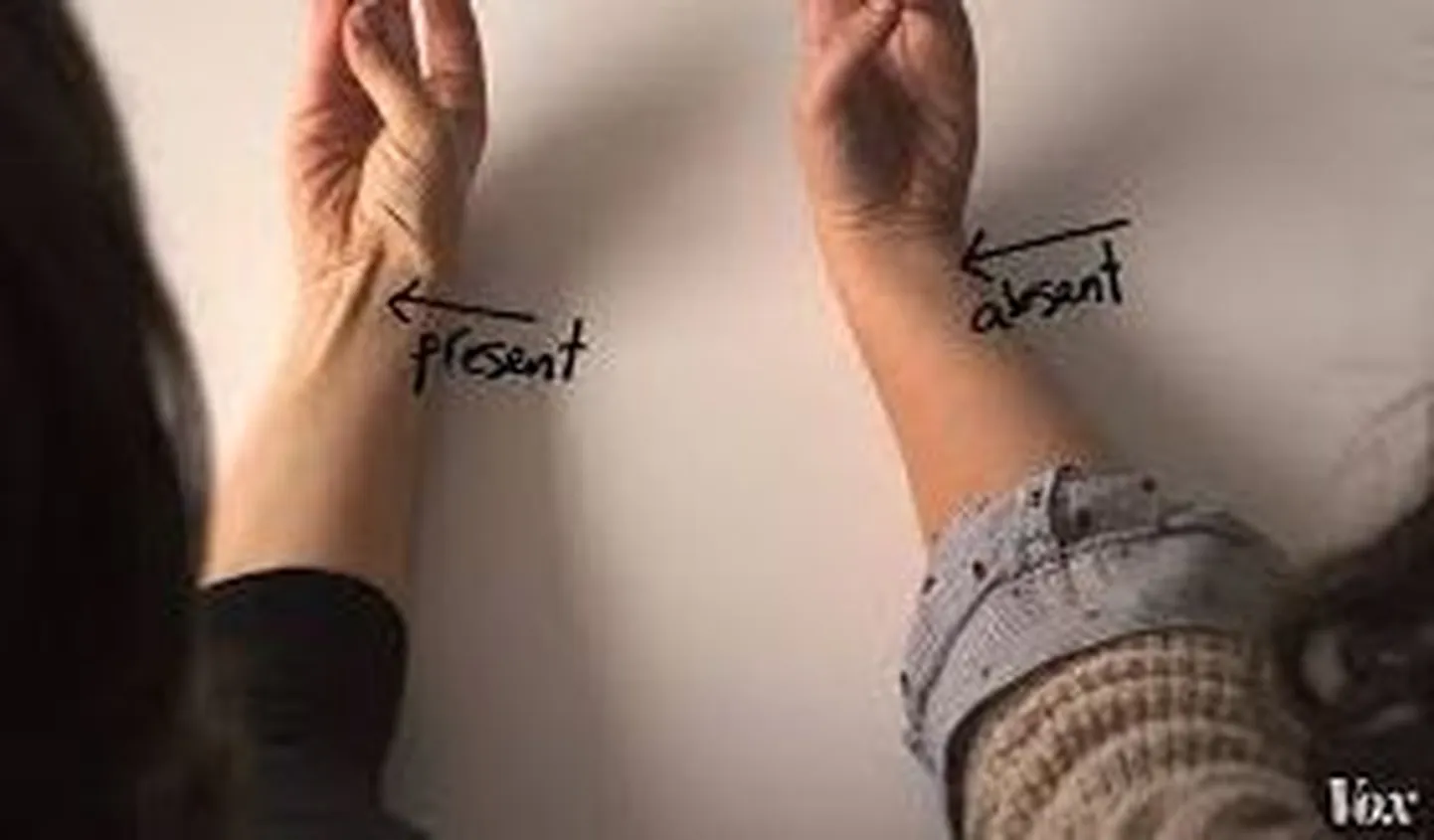 Artikli foto