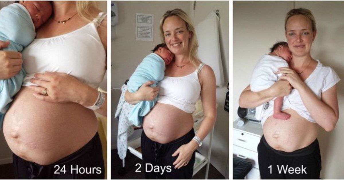 Родила 3 недели. Живот после рождения ребенка. До и после беременности.
