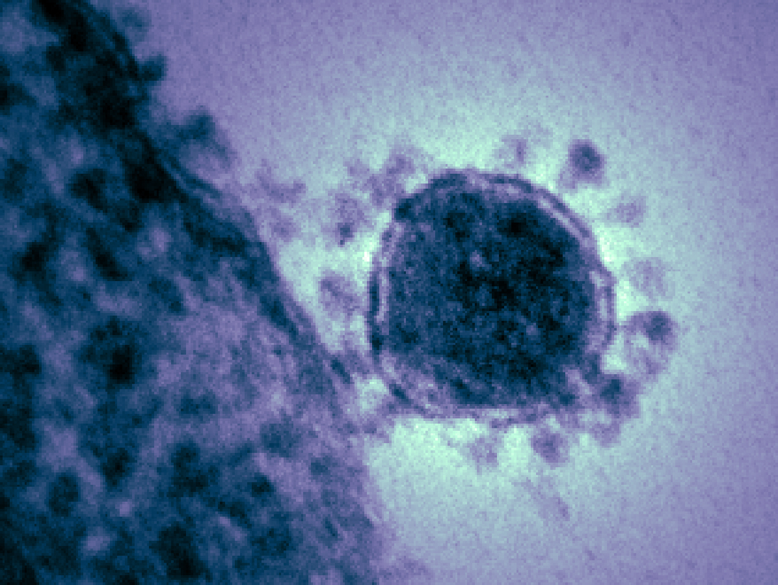 Respiratoorse sündroomiga Lähis-Ida koroonaviiruse MERS osake mikroskoobis. Pildil näha olev kuma ümber osakese on andnud viiruste suguvõsale ka nime.