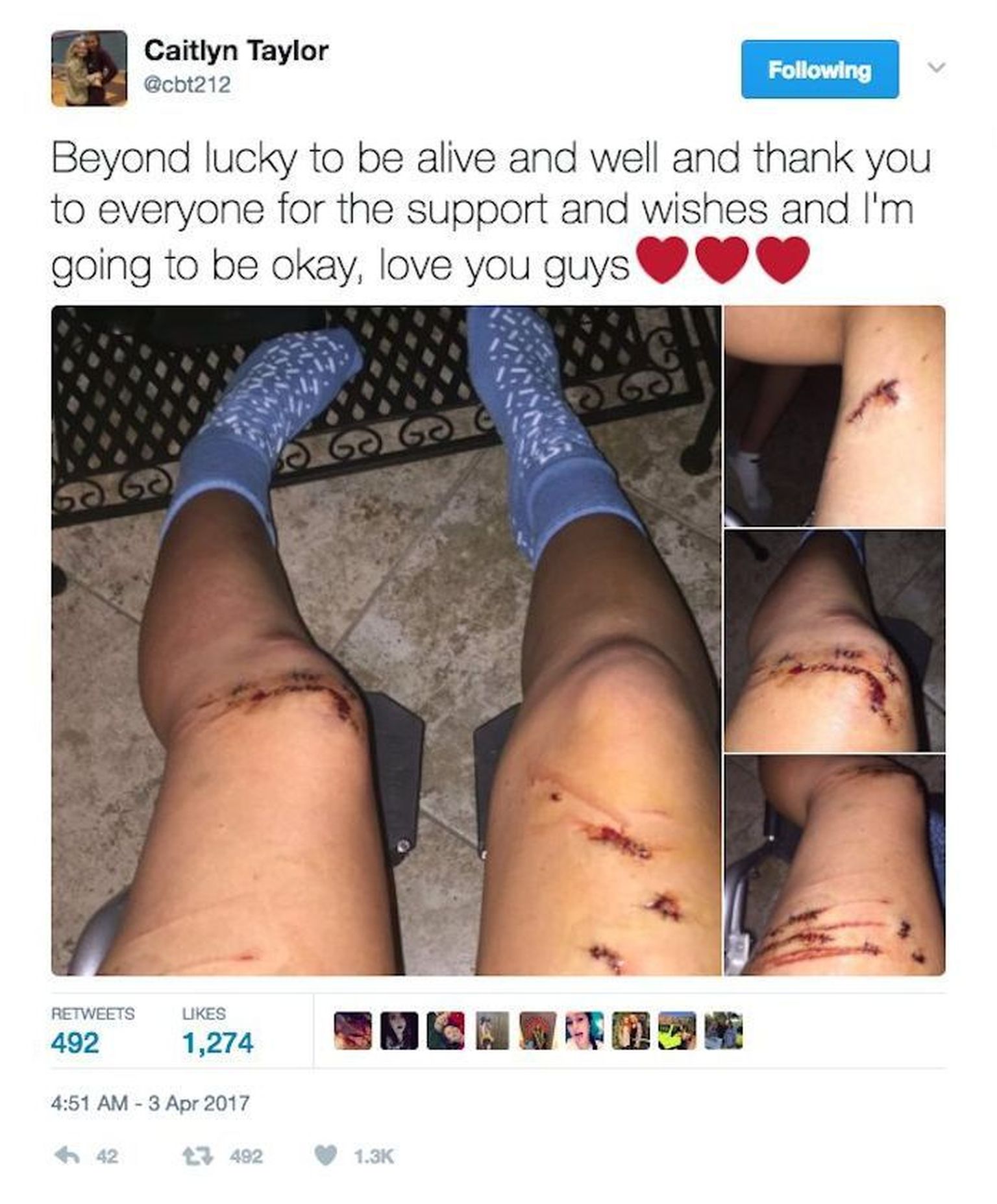 Caitlyn Taylori vigastused