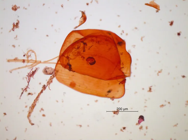 Vesikirbu (Alona quadrangularis) kest 250 kordse suurendusega.