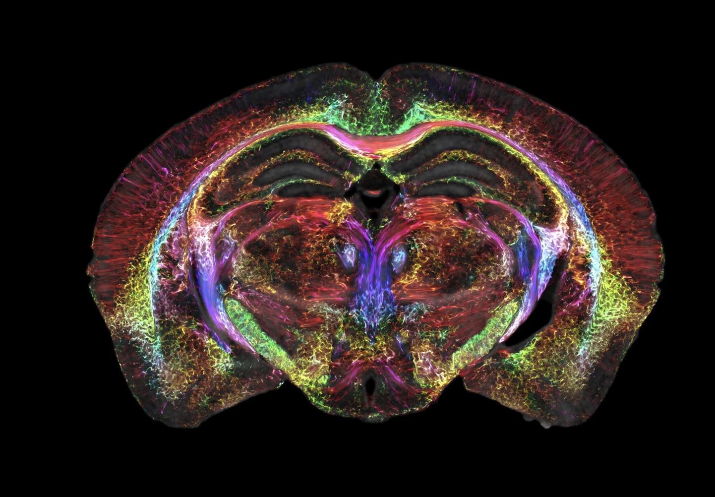 Uus MRT masin annab üksikasjaliku ülevaate hiire ajust
