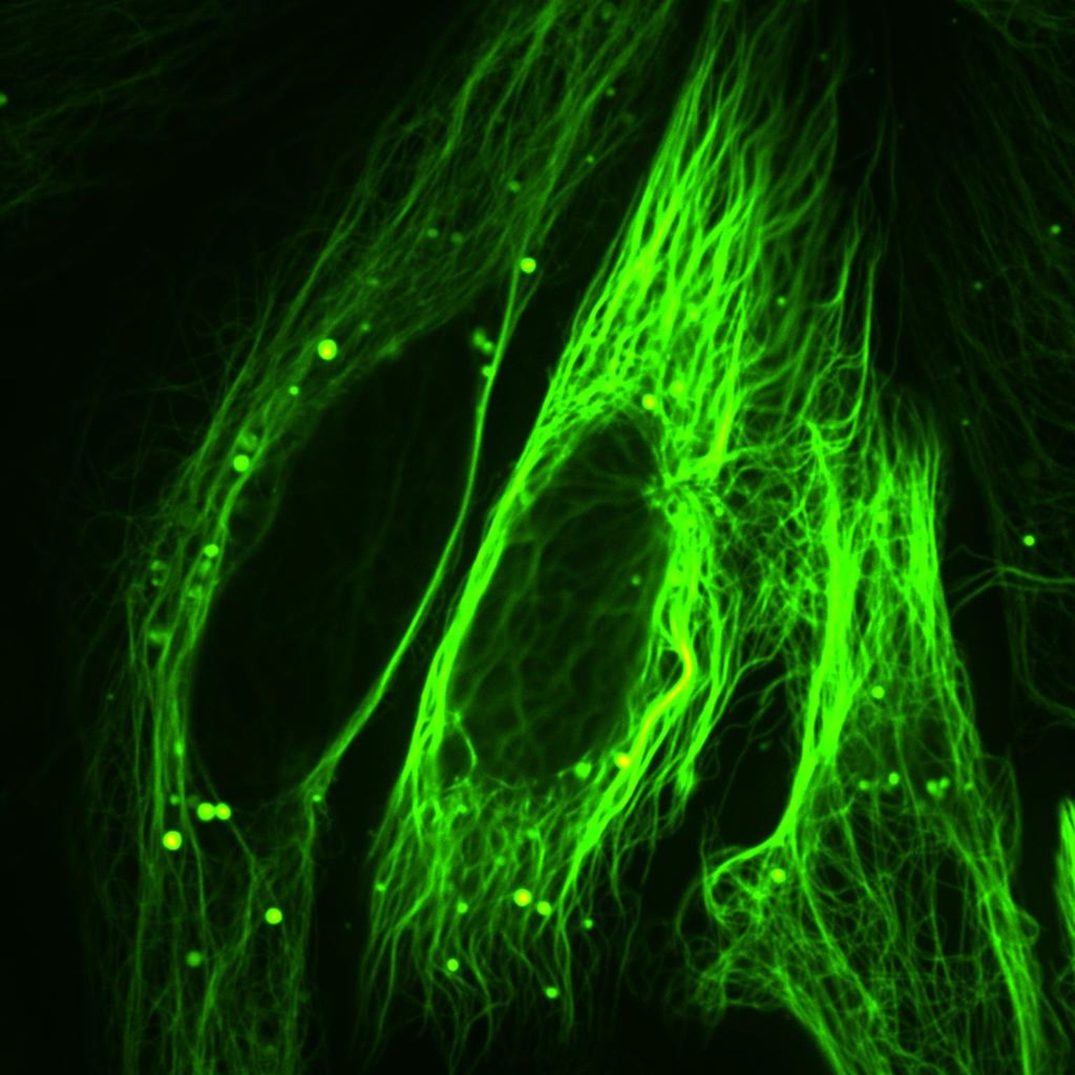 Luminestseeruv tubuliin neuronis.