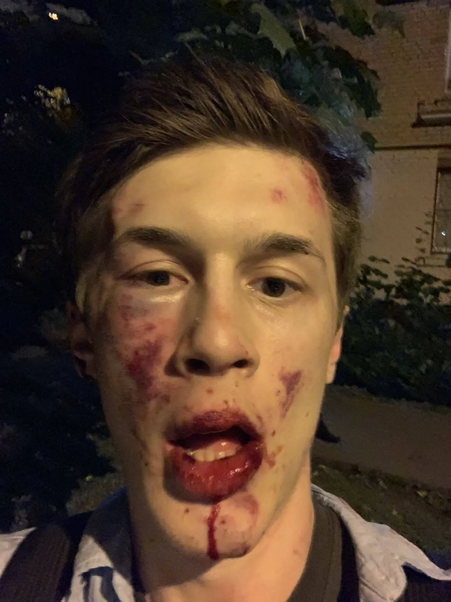 Venemaal peksti läbi opositsiooniline blogija ja raadiojaama Ehho Moskvõ saatejuht Jegor Žukov.