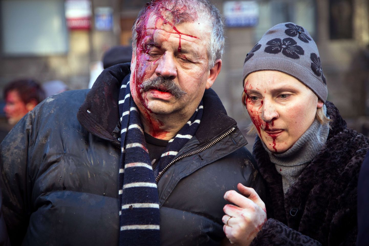 Eilsete kokkupõrgete käigus viga saanud Kiievi protestijad.