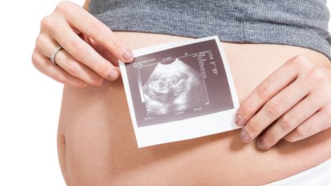 Sünnitajate vanuse jätkuv tõus toob kaasa suurenenud riski loote kromosoomhaiguste, näiteks Downi sündroomi esinemiseks. Sünnitajate vanuse jätkuv tõus toob kaasa suurenenud riski loote kromosoomhaiguste, näiteks Downi sündroomi esinemiseks.