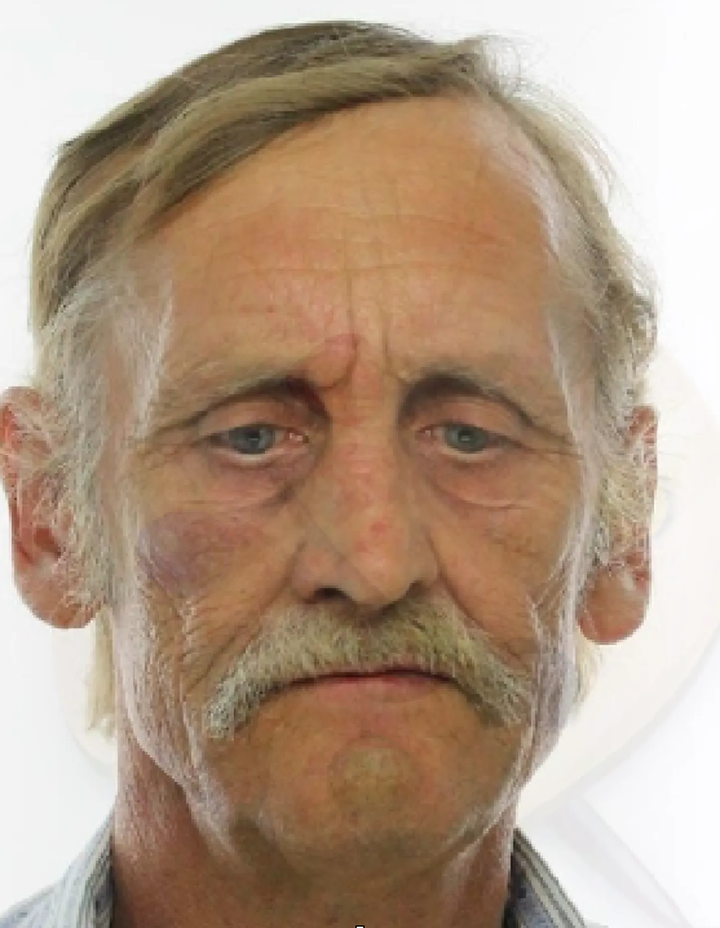 Kadunud Rainer.