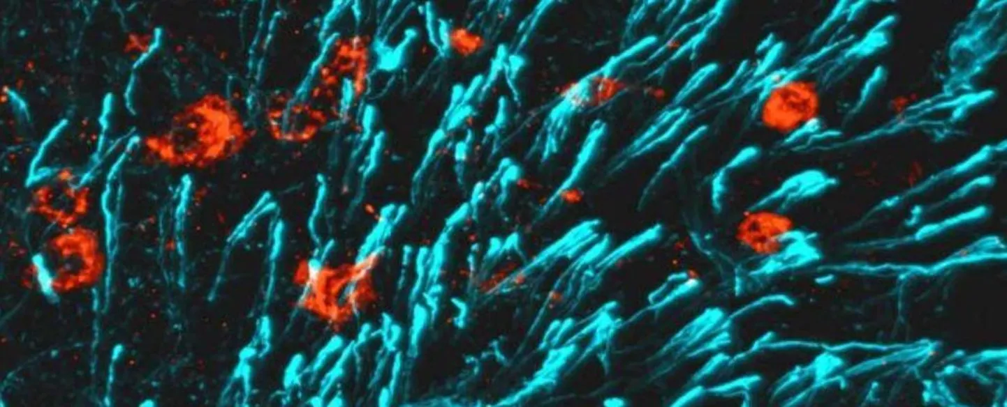 MBH neuronites (punasega), mis külgnevad teiste rakkudega (sinisega)
