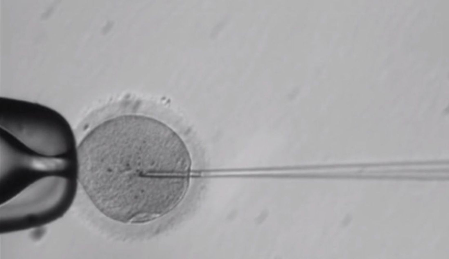 Kaader videost, mis näitab kuidas geene muutvad kemikaalid süstitakse inimese munarakku viljastamise momendil, et korrigeerida vigu, mis esinevad mehe spermas.