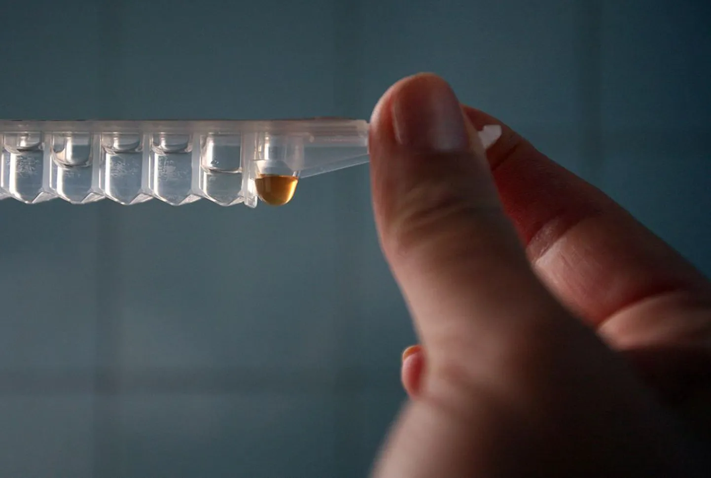 HIV-test.