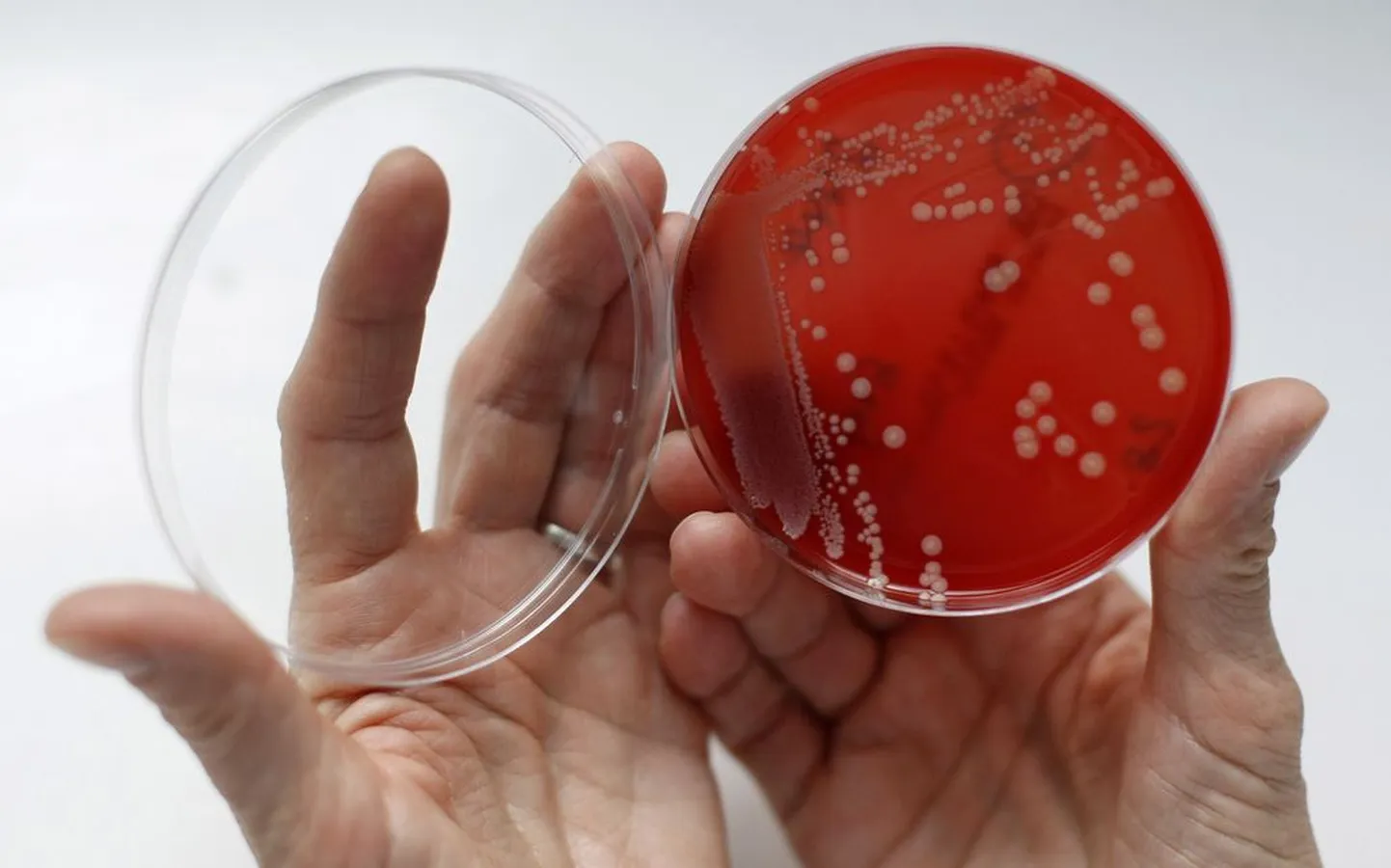 Ravimitele resistentsed MRSA bakterid Petri tassil..