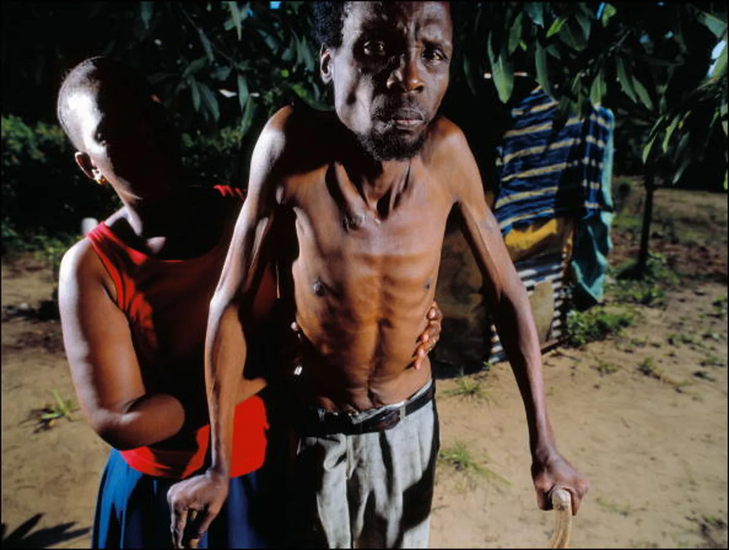 AIDSihaige Lõuna-Aafrikas. Foto on illustratiivne.