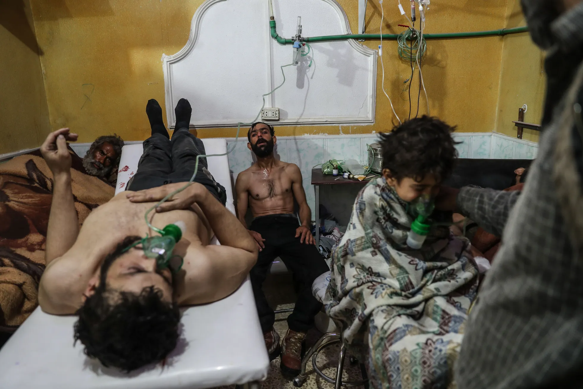 Mees ja laps saamas arstiabi pärast Ida-Ghouta al-Shifunieh` linnajaole korraldatud arvatavat gaasirünnakut. Süüria, 25. veebruar 2018.