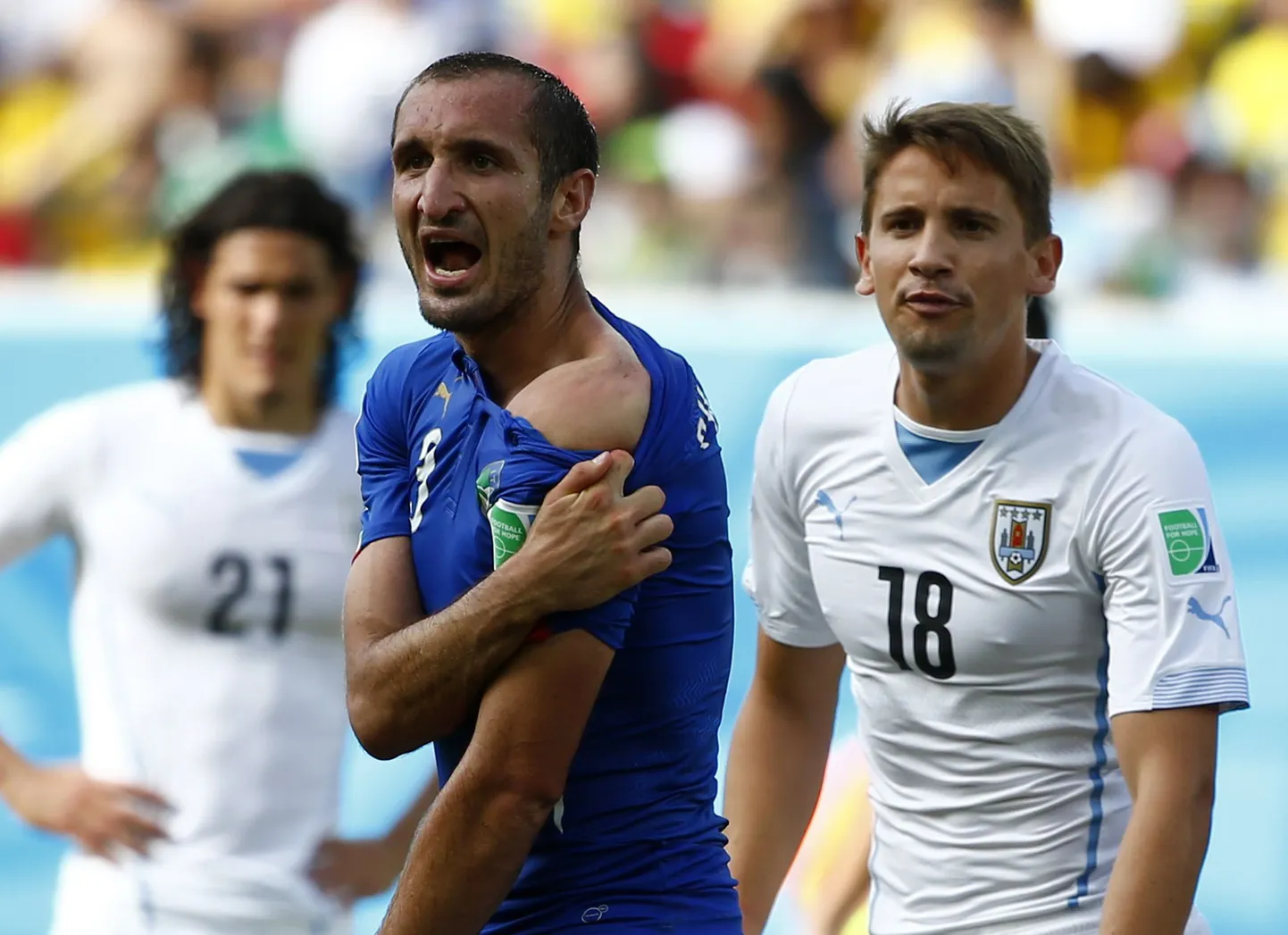 Giorgio Chiellini näitab kohtunikele hammustusjälgedega õlga.