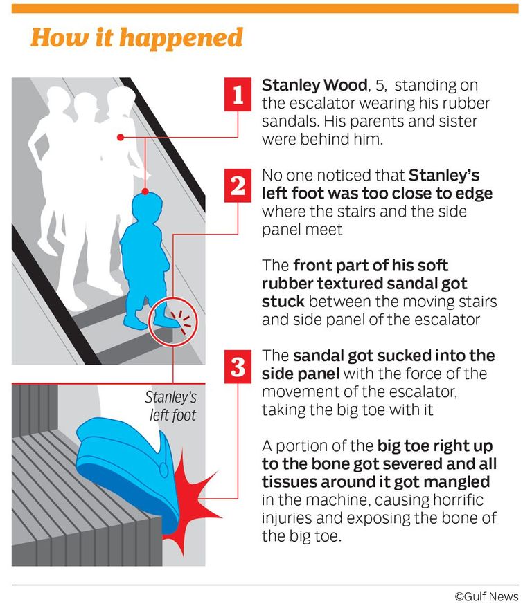 Joonis selle kohta, kuidas Stanley jalg eskalaatori vahele jäi.