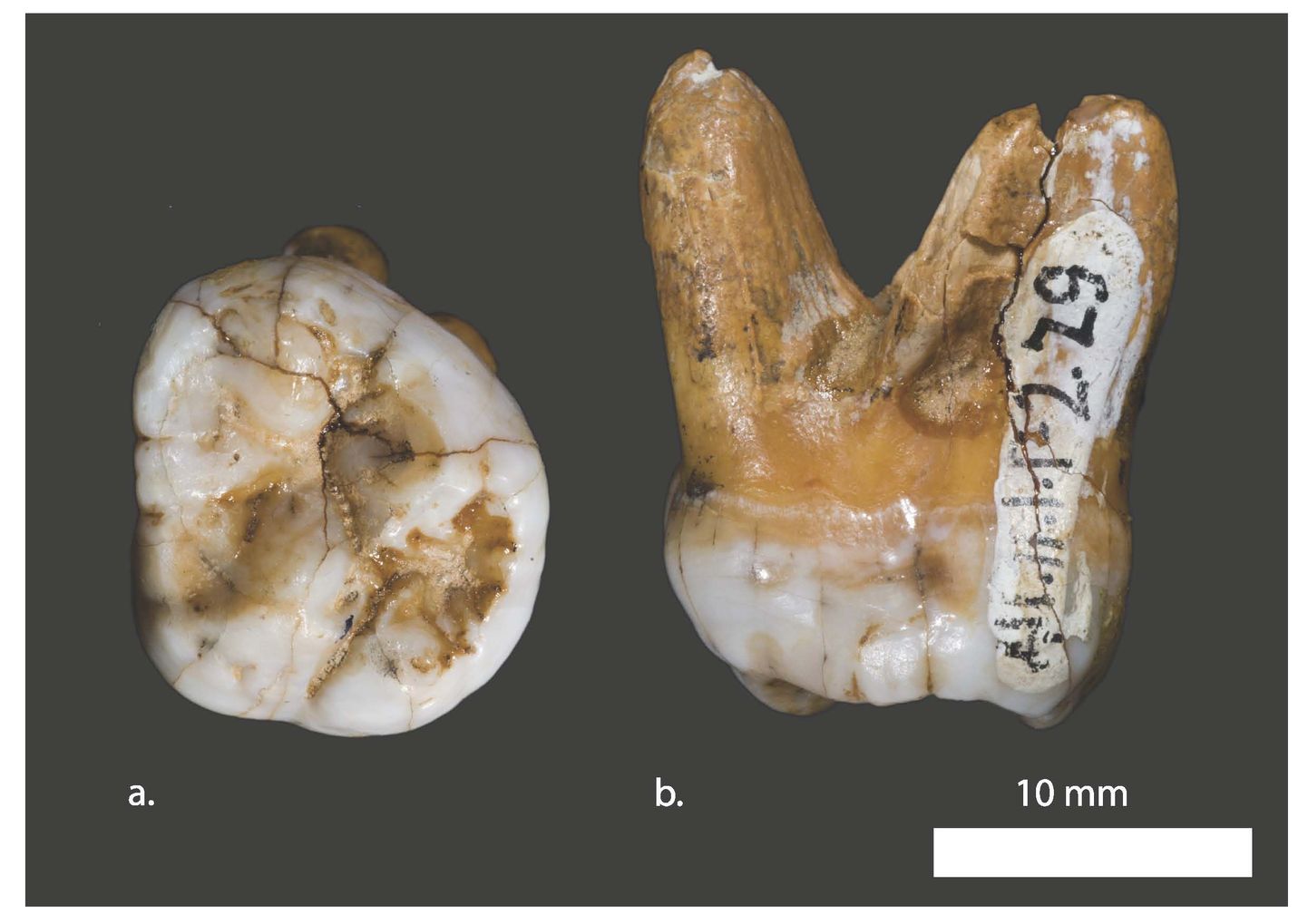 Siberist Denisova koopast leitud iidse inimliigi - Denisova inimese - hammas