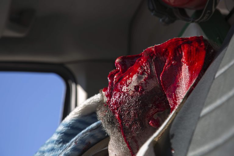 Haavatu kiirabiautos, mis sattus tule alla.  Foto:   KARAM AL-MASRI/AFP/Scanpix