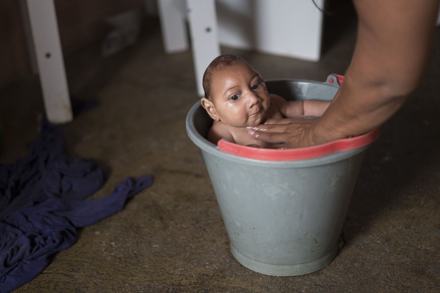 Zikaga seostatav mikrotsefaalia tähendab imiku normaalsest väiksemat pead – nagu pildiloleval José Wesleyl.