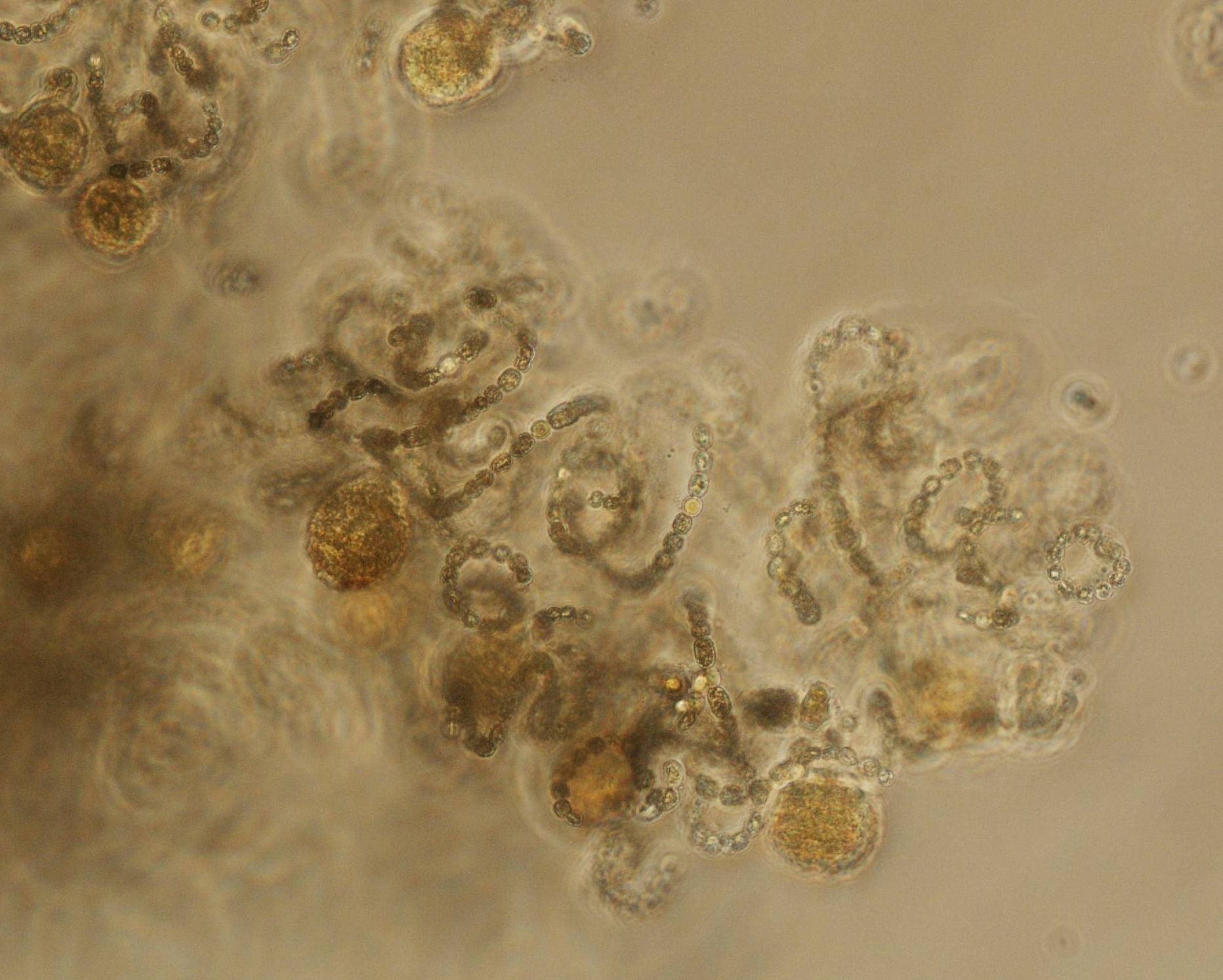Laupäeval järvest võetud veeproovis tuvastatud sinivetikas Dolichospermum utermoehlii mikroskoobis 200 korda suurendatult.