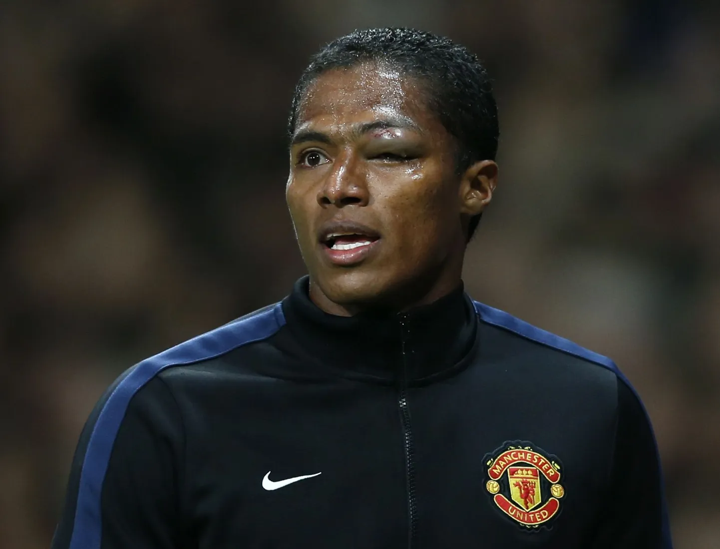 Manchester Unitedi poolkaitsja Antonio Valencia lahkus Olympiakose vastu peetud mängult mitte just kõige kaunima välimusega.