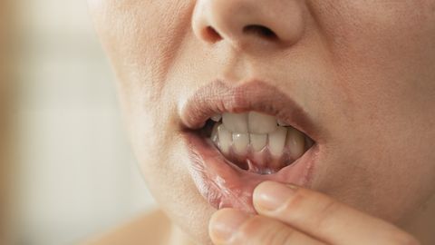 ETTEVAATUST! ⟩ See tervislik vahepala võib hammastele rohkem kahju teha, kui arvad