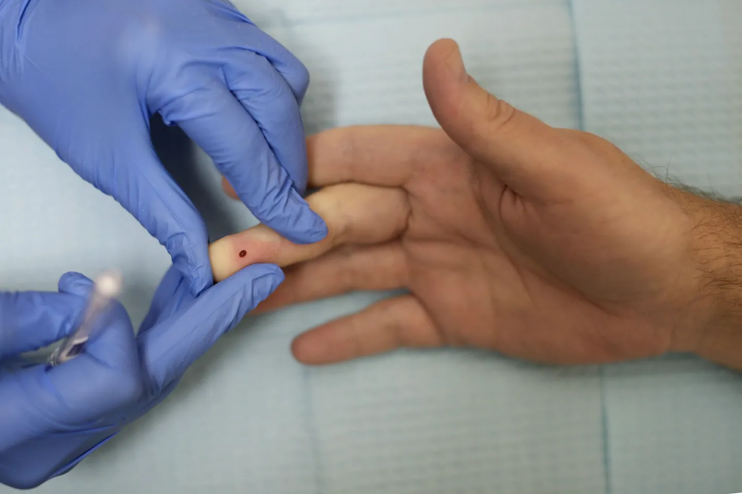Vereproovi võtmine HIV-testi tegemiseks.