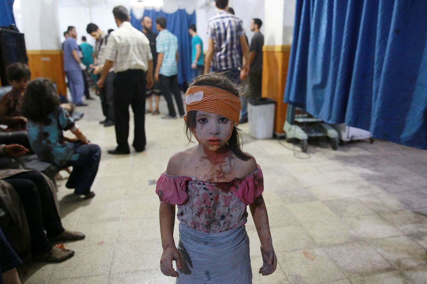 Маленькая сирийская девочка в госпитале. Август 2015, когда произошел очередной обстрел района Домаска.