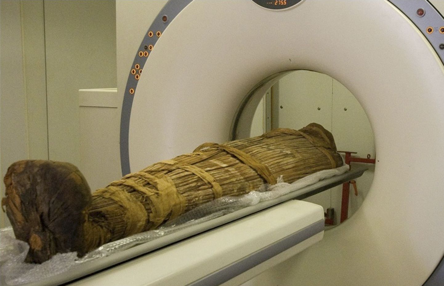 2600-aastase muumia koljust leiti aju väljatõmbamise konks