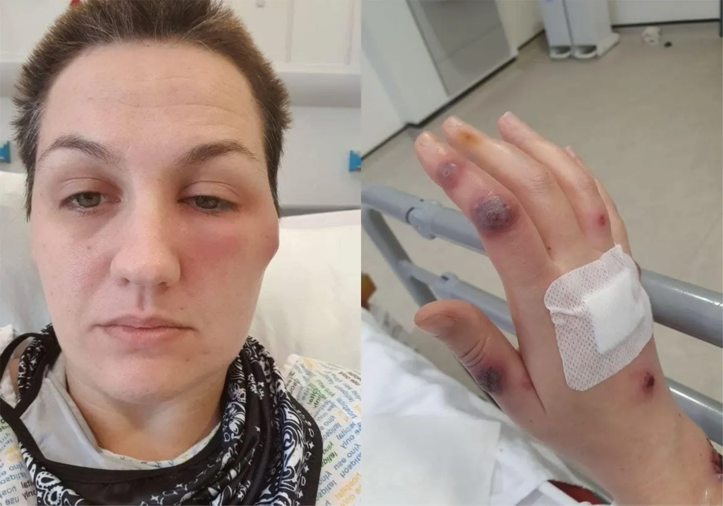 Вакцинация чуть было не стоила Саре обеих ног