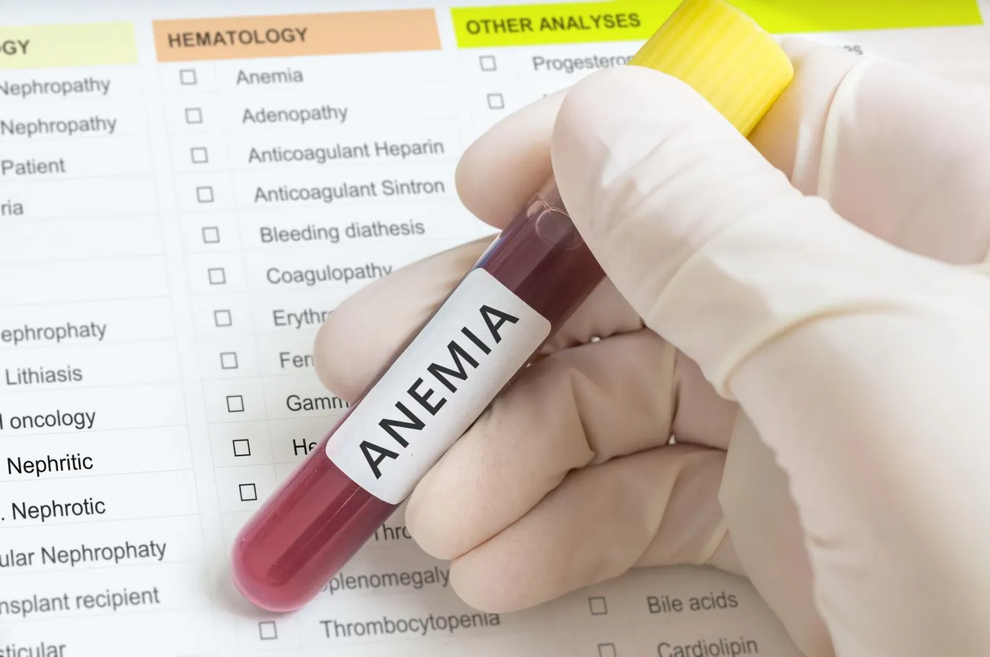 Aneemia ehk kehvveresus on maailmas kõige levinum verehaigus, arvatakse, et seda esineb rohkem kui 1,3 miljardil inimesel.