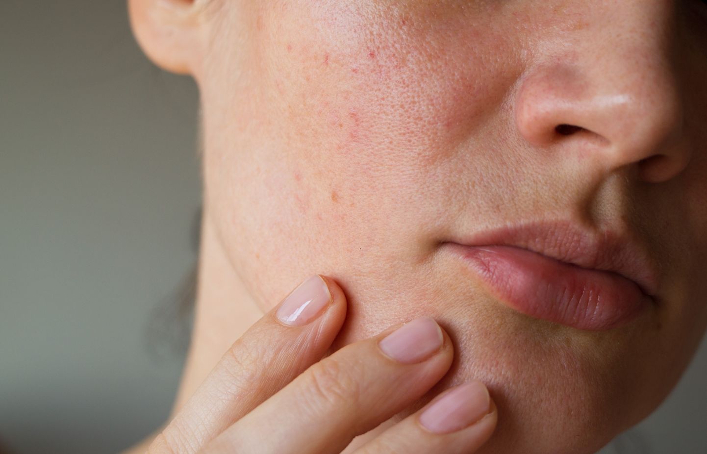 Enamasti saab naha kuivust ja kiskuvat tunnet vältida korrigeerides vaid mõnda igapäevast harjumust naha eest hoolitsemisel.