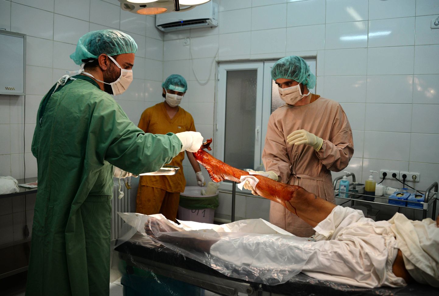 Fotol Afganistanis Talibani konfliktis viga saanud patsient kohalikus traumakeskuses.