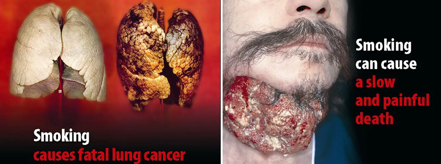 Oktoobrist ilmusid Suurbritannias sigaretipakkidele suitsetamise vähiriskidest teavitavad fotod.