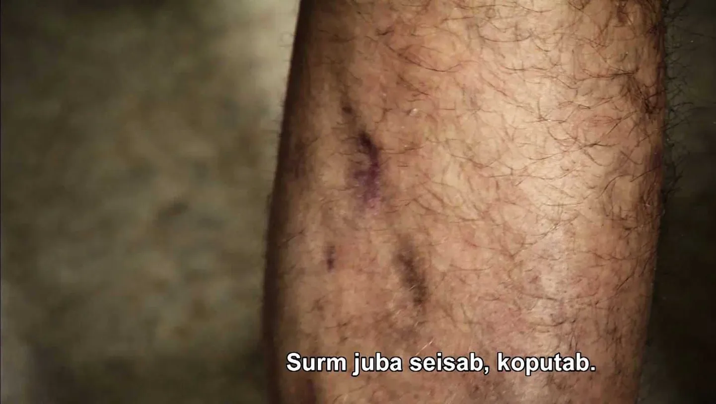 «Radar»