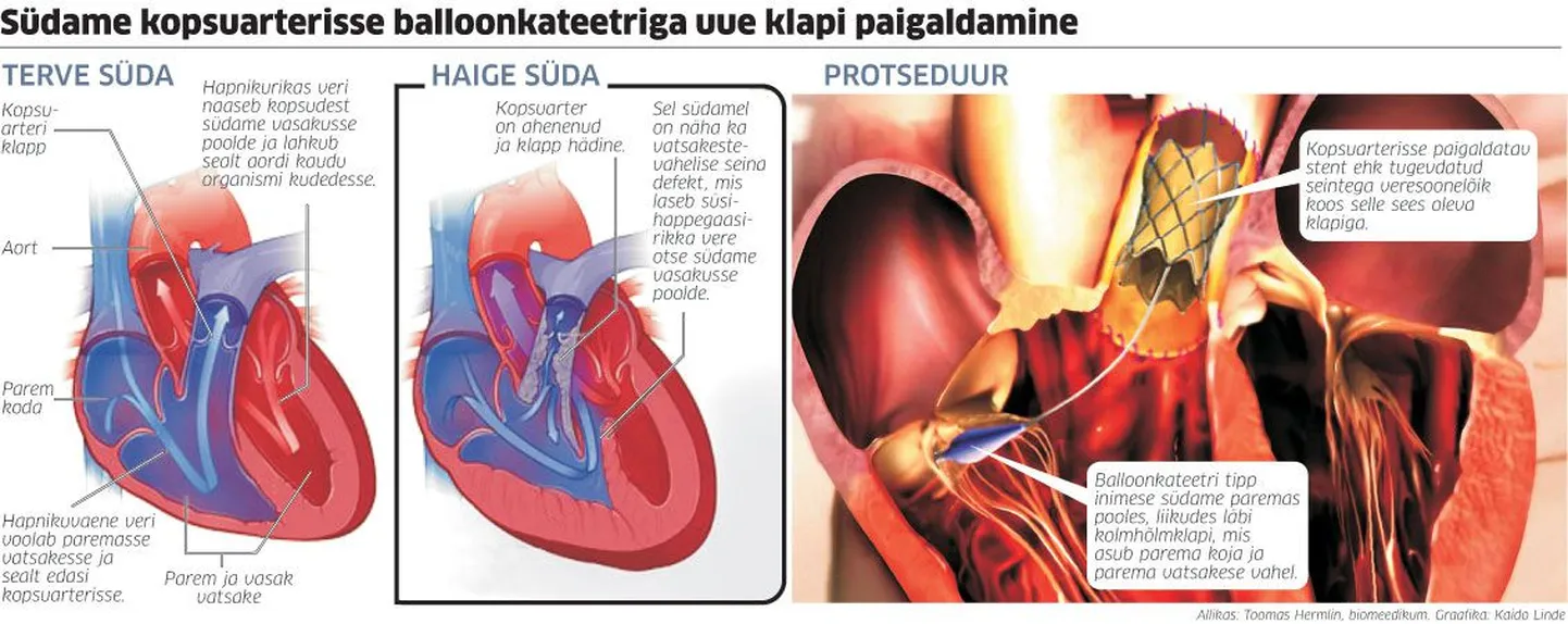 Article photo