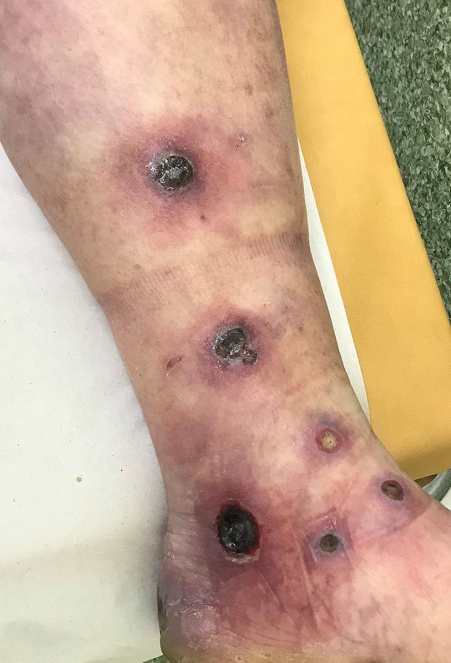 Фото ноги пациента.