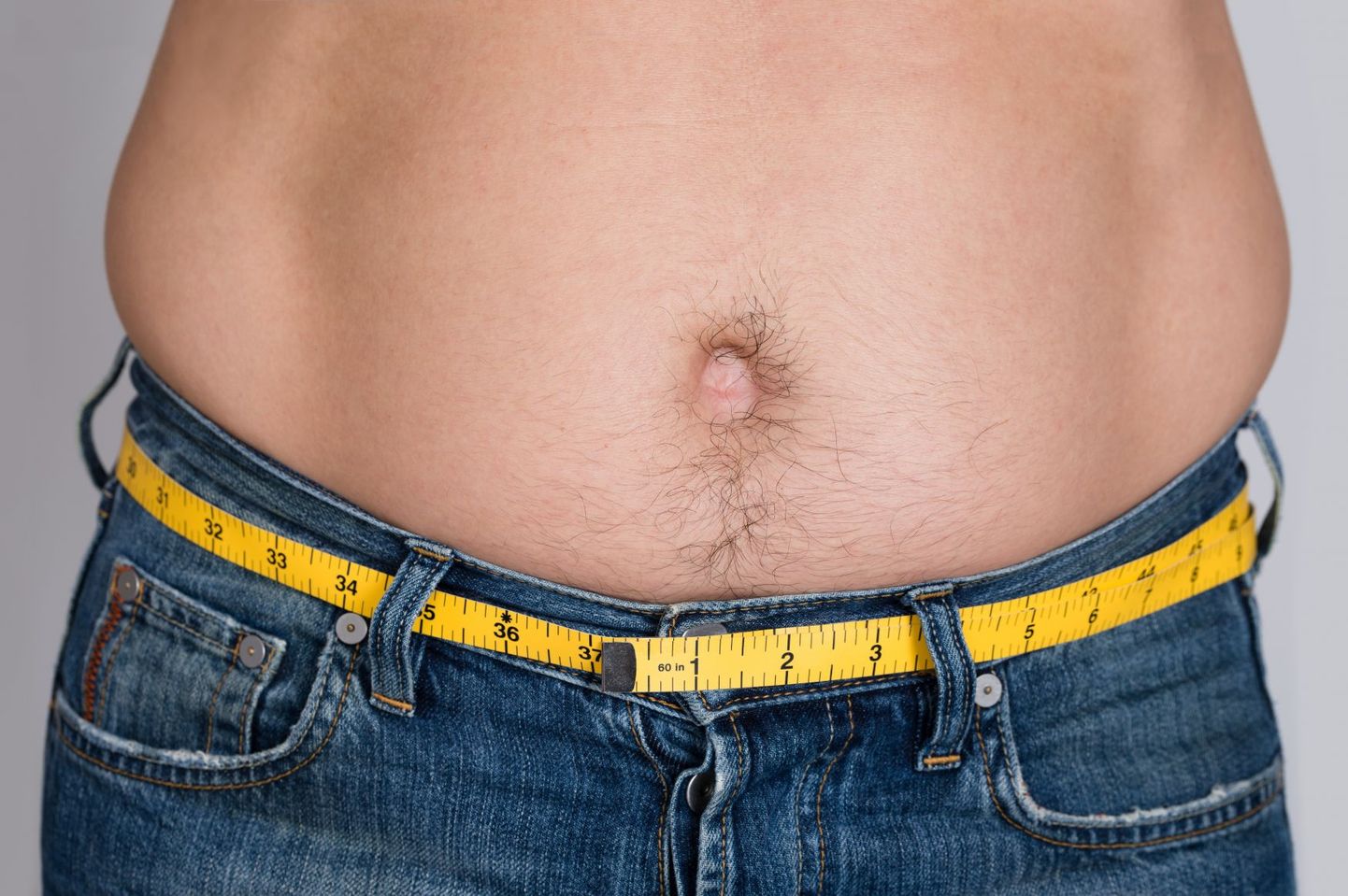 Elunditevahelist rasva võib olla liiga palju ka siis, kui kehamassiindeks (KMI) on normide piires.