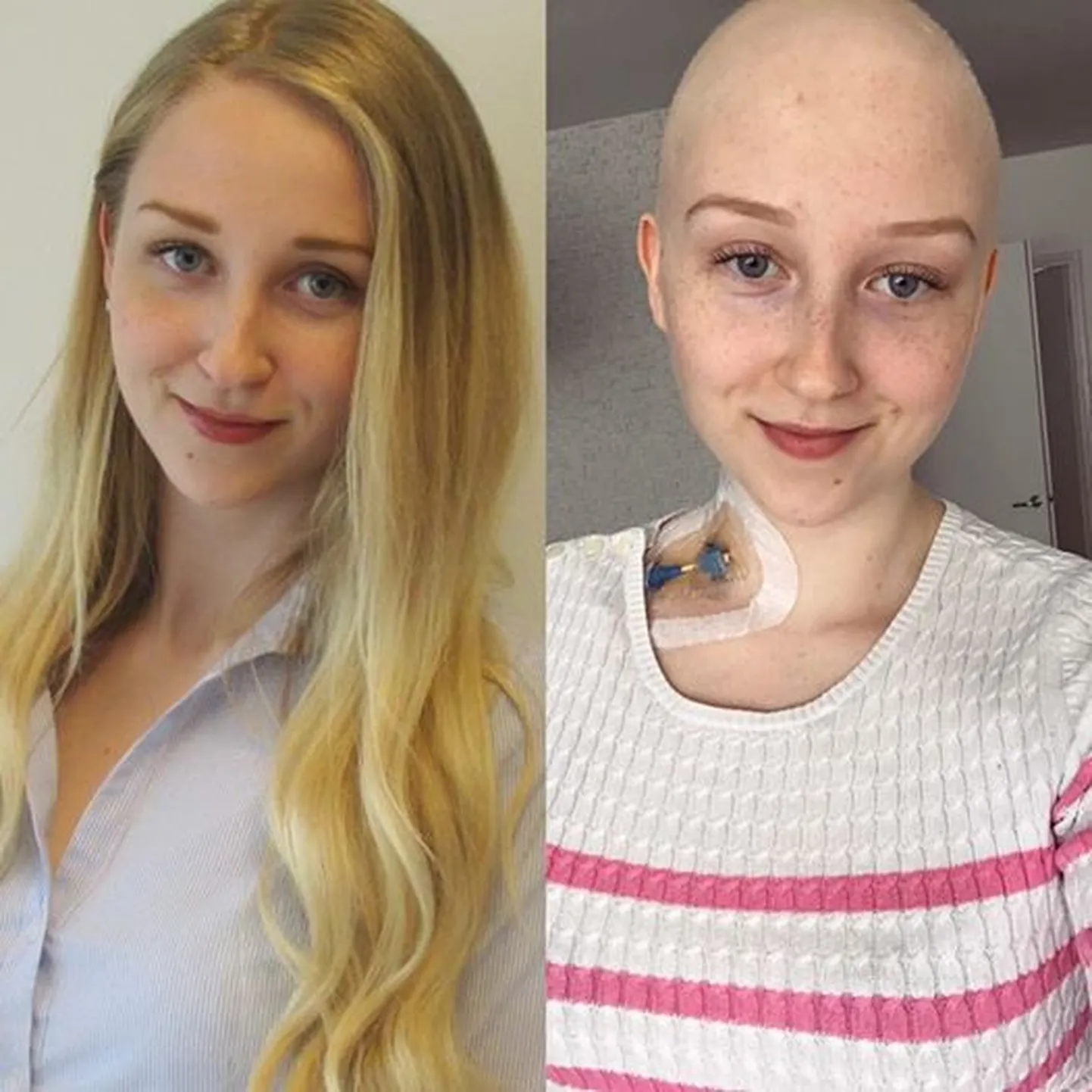 Vivian püüab tuua rohkem tähelepanu luuüdiregistrile.