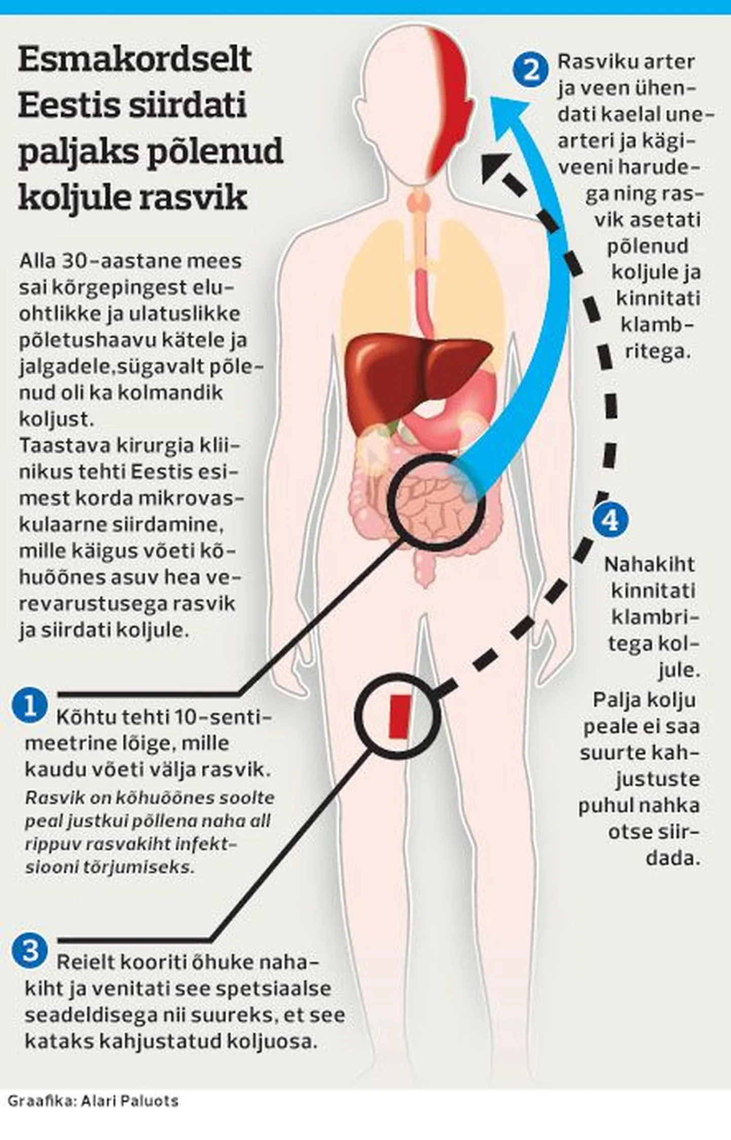 Article photo