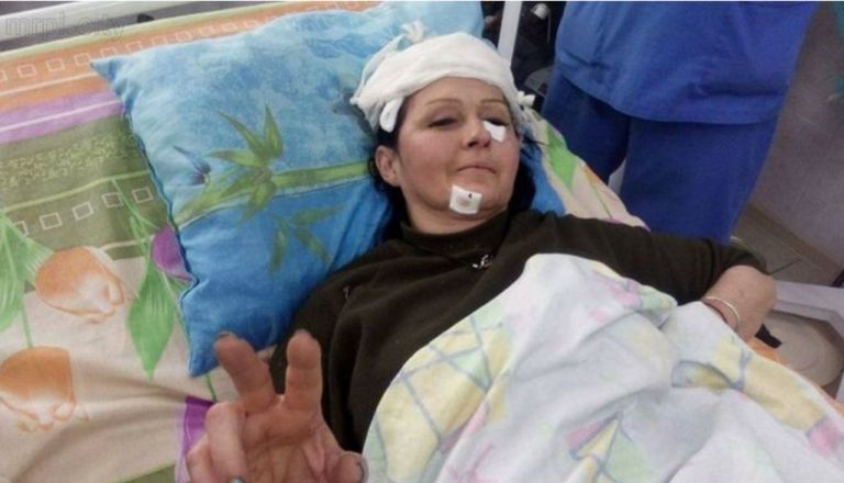 Юлия Толмачева в Бахмутской районной больнице после ранения.