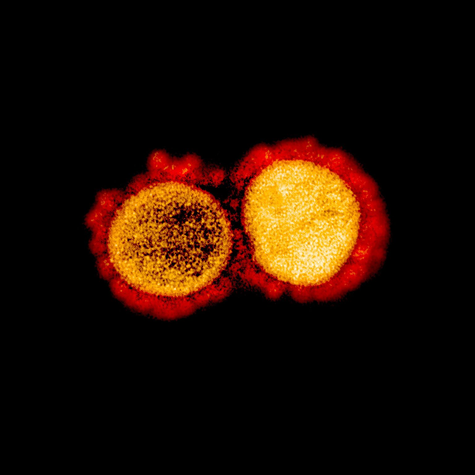SARS-CoV-2 vīrusa daļiņas.
