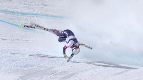 "Man bija trešā operācija." Vona dalās ar fotogrāfijām no slimnīcas