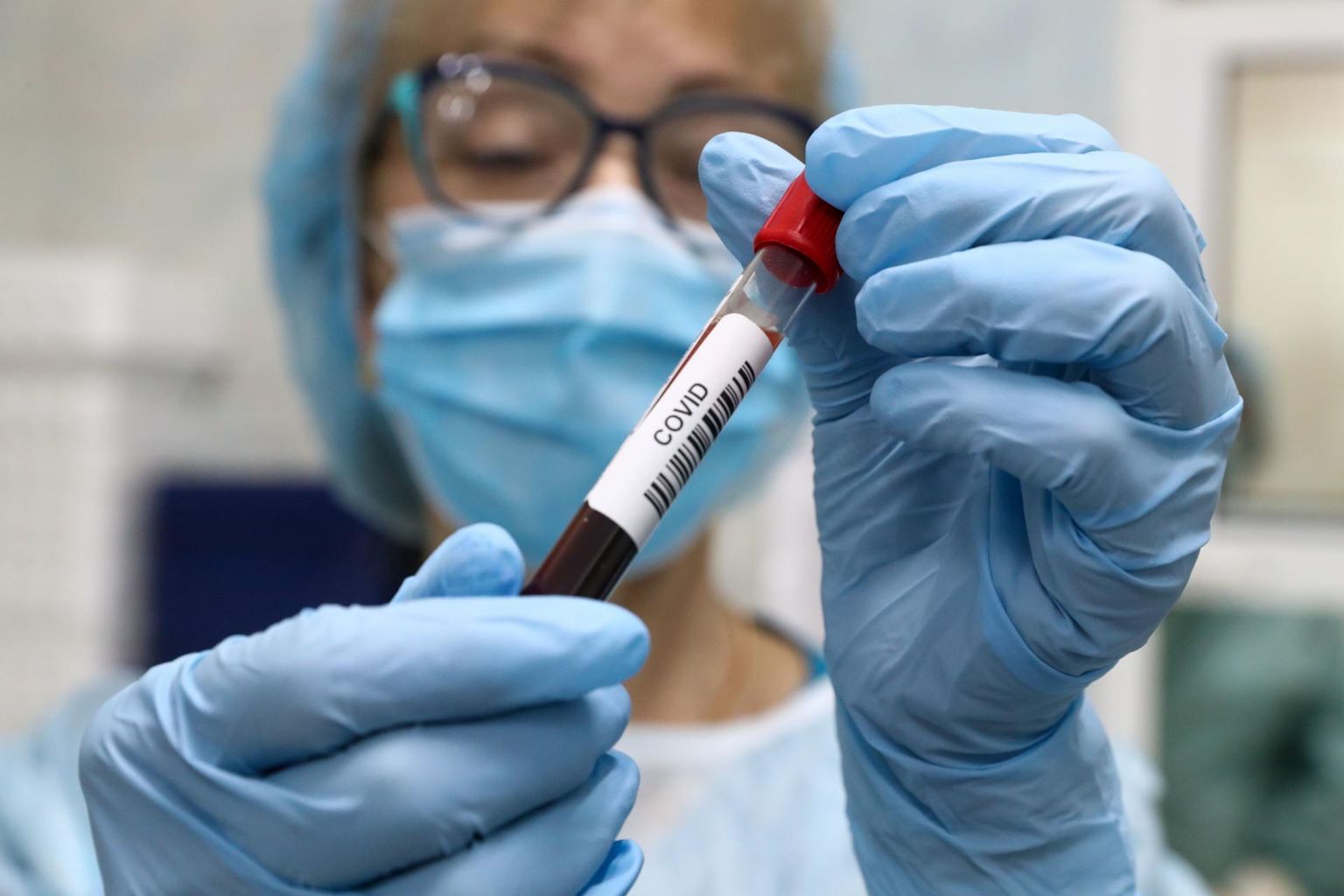  p evaga Lisandus ks Positiivne Koroonaviiruse Test