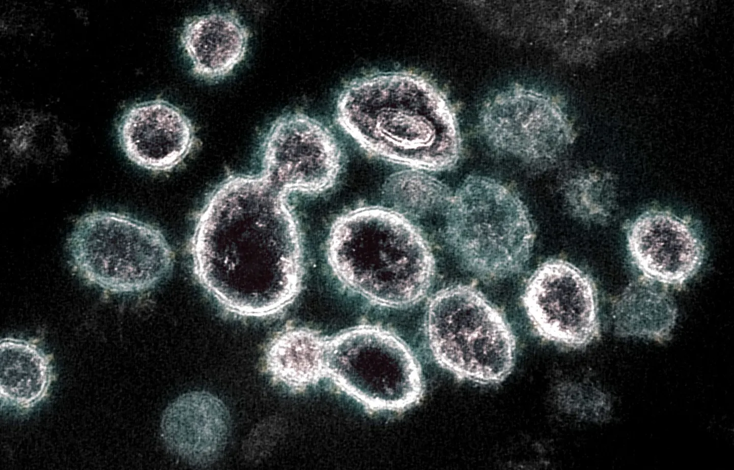 COVID-19 haigust põhjustav SARS-CoV-2 viirus.