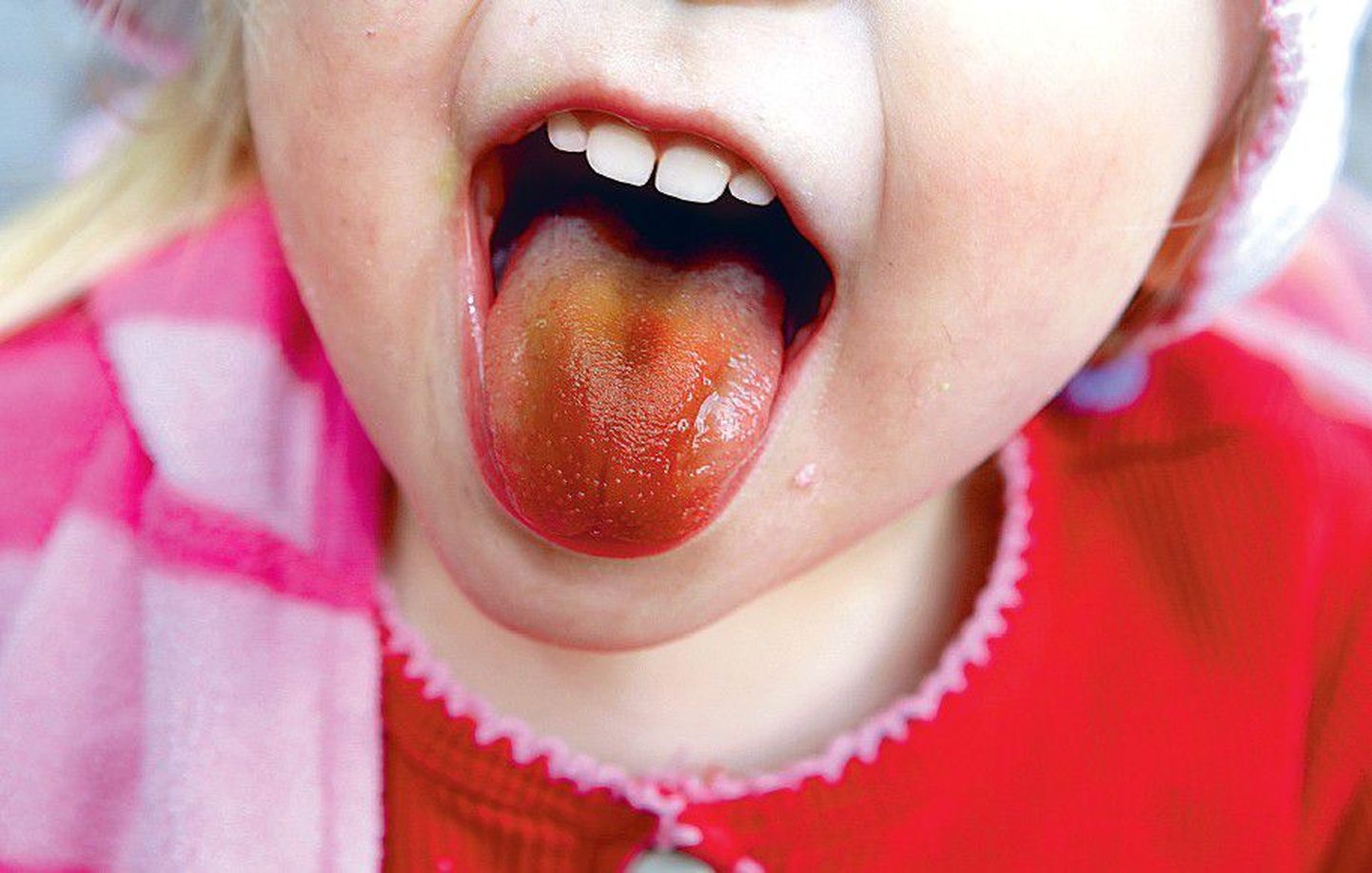 Lastele teeb kindlasti nalja, kui pulgakomm keele tumepunaseks või erelillaks värvib, aga nende tervisele võivad toiduvärvid tõsist häda teha.