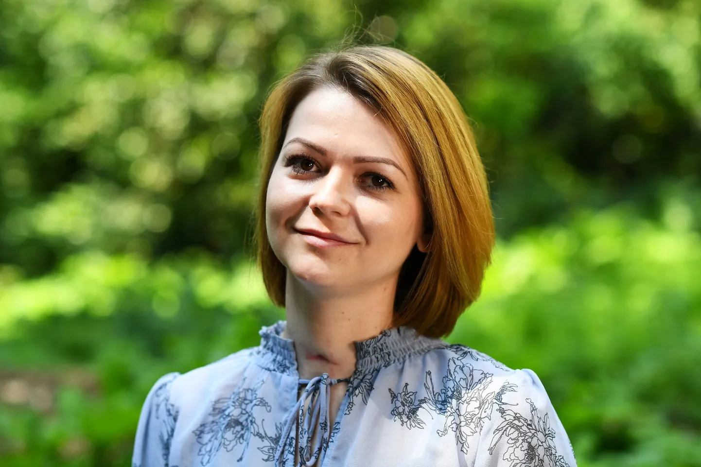 Märtsi alguses koos oma isa, endise luuraja Sergei Skripaliga närvimürgi Novitšok rünnaku ohvriks langenud Julia Skripal astus esimest korda pärast haiglast pääsemist avalikkuse ette eelmisel nädalal, kui tegi videopöördumise, kus rääkis juhtunust ja tulevikuplaanidest. Naise kaelal on näha arm kohal, kuhu oli kinnitatud hingamistoru.