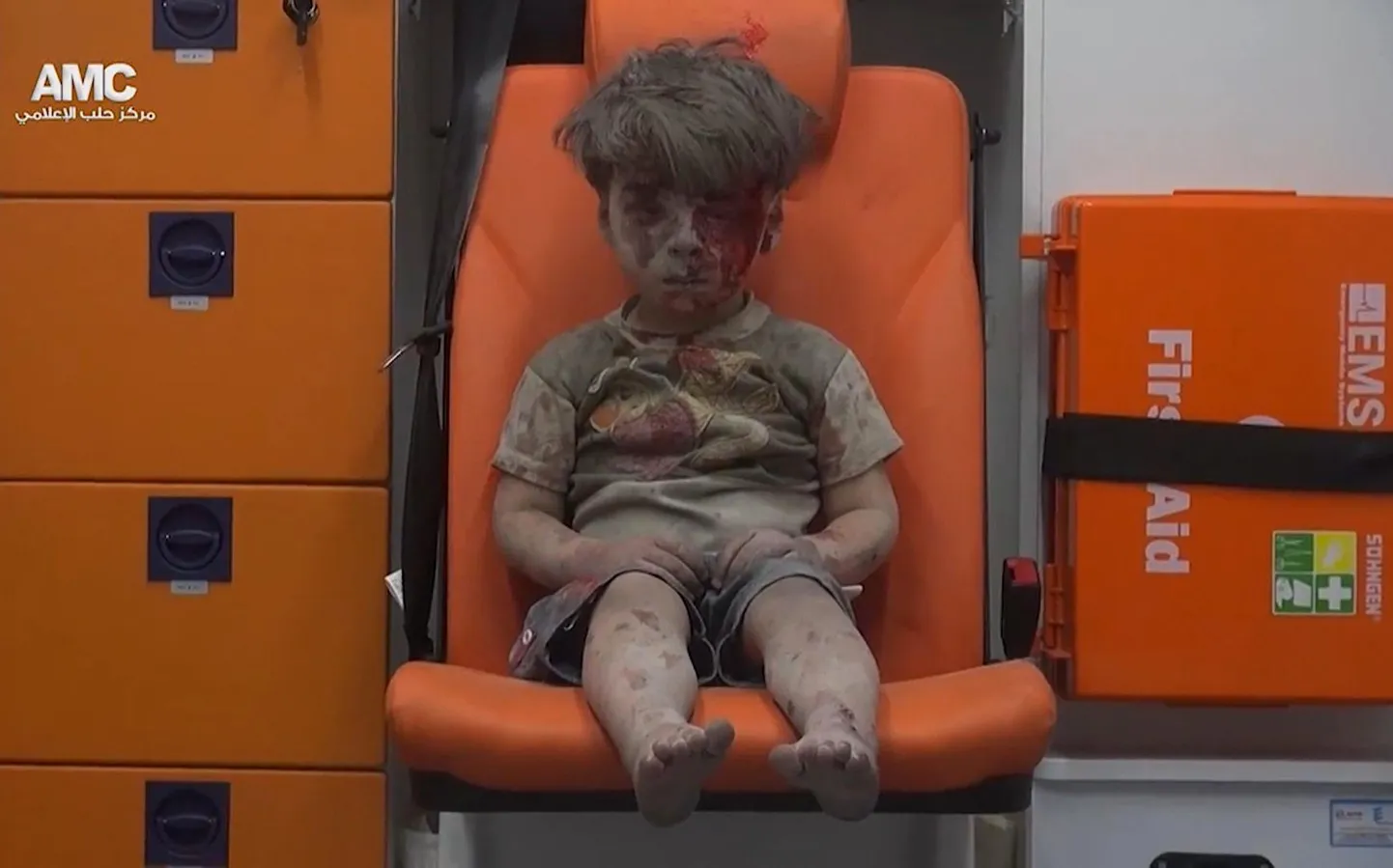 Süürias arvatavas Vene õhurünnakus vigastada saanud nelja-aastane Omran.